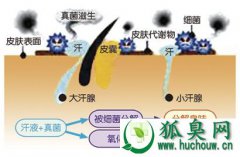 狐臭用什么好 治疗狐臭的常用的办法大盘点